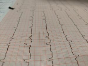 冷房病の対策はどれが効果的？